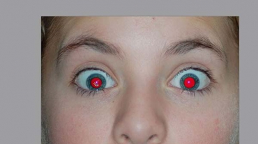 red-eye-removal