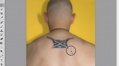 tattoo-removal
